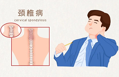 警惕！骨與關(guān)節(jié)的“健康危機(jī)”，你中招了嗎？